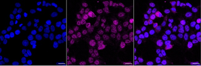 SRSF9 Antibody in Immunocytochemistry (ICC/IF)