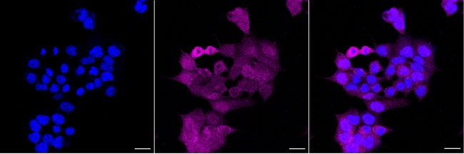 SOCS2 Antibody in Immunocytochemistry (ICC/IF)