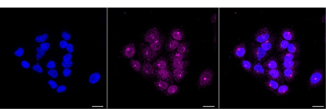 SMAD2 Antibody in Immunocytochemistry (ICC/IF)
