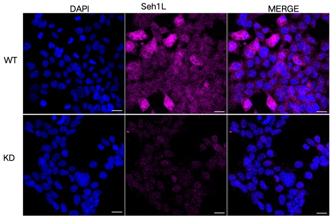 SEH1L Antibody in Immunocytochemistry (ICC/IF)