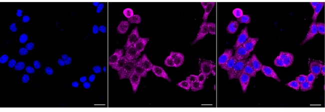 RPSA Antibody in Immunocytochemistry (ICC/IF)