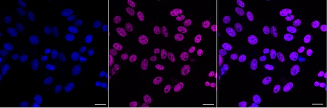 RBMX Antibody in Immunocytochemistry (ICC/IF)