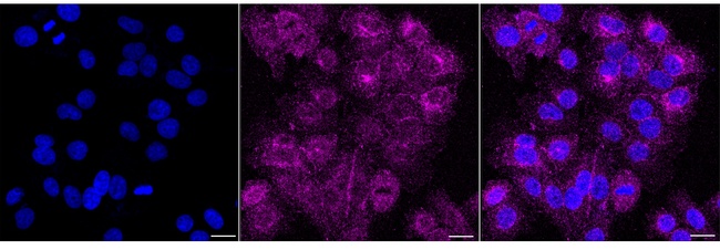 RAP1B Antibody in Immunocytochemistry (ICC/IF)