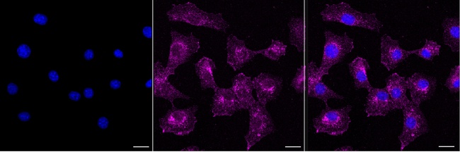 RALB Antibody in Immunocytochemistry (ICC/IF)
