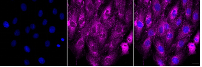 RAB10 Antibody in Immunocytochemistry (ICC/IF)