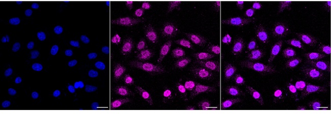 PRDX2 Antibody in Immunocytochemistry (ICC/IF)