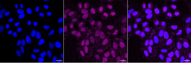 NTHL1 Antibody in Immunocytochemistry (ICC/IF)