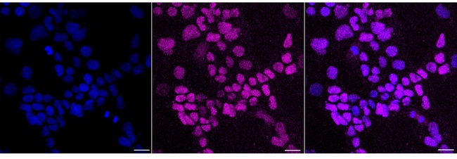 NTHL1 Antibody in Immunocytochemistry (ICC/IF)