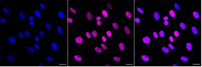 NR2F2 Antibody in Immunocytochemistry (ICC/IF)