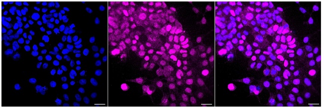 Nkx2.1 Antibody in Immunocytochemistry (ICC/IF)