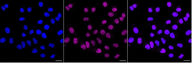 Menin Antibody in Immunocytochemistry (ICC/IF)