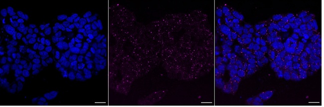 LSM1 Antibody in Immunocytochemistry (ICC/IF)