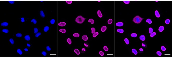 Lamin A/C Antibody in Immunocytochemistry (ICC/IF)