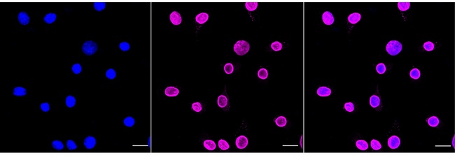 Lamin A/C Antibody in Immunocytochemistry (ICC/IF)