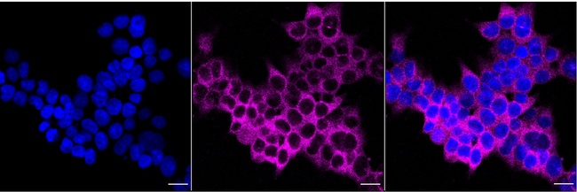 KIF1B Antibody in Immunocytochemistry (ICC/IF)