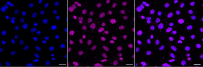 KDM2A Antibody in Immunocytochemistry (ICC/IF)
