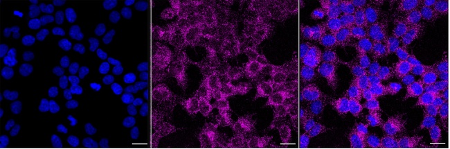 KATNAL1 Antibody in Immunocytochemistry (ICC/IF)