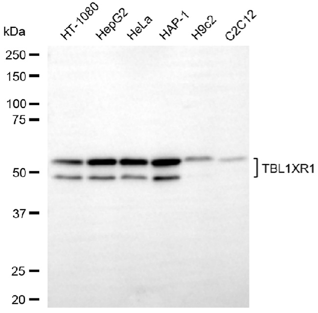 TBLR1 Antibody in Western Blot (WB)