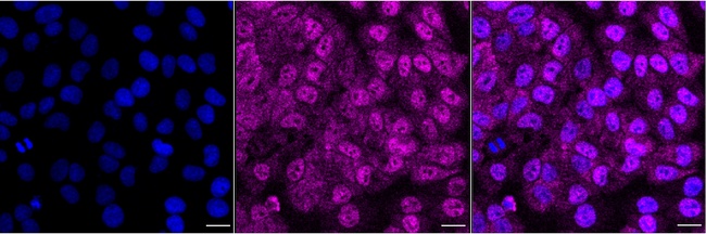 SMN1 Antibody in Immunocytochemistry (ICC/IF)