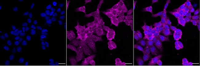 SMN1 Antibody in Immunocytochemistry (ICC/IF)