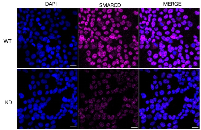SMARCD1 Antibody in Immunocytochemistry (ICC/IF)