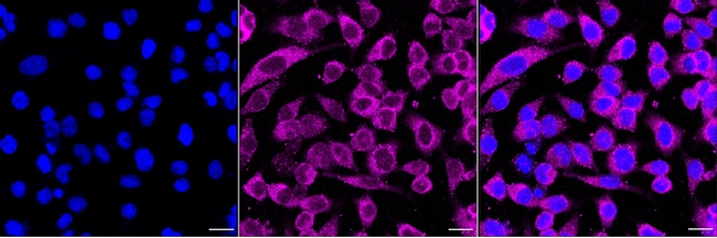 ROCK1 Antibody in Immunocytochemistry (ICC/IF)