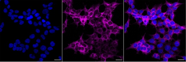ROCK1 Antibody in Immunocytochemistry (ICC/IF)