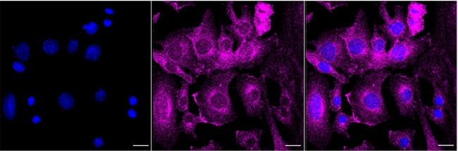 RhoC Antibody in Immunocytochemistry (ICC/IF)