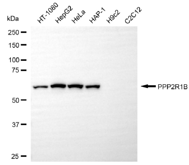 PPP2R1B Antibody in Western Blot (WB)