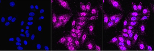 PPM1B Antibody in Immunocytochemistry (ICC/IF)