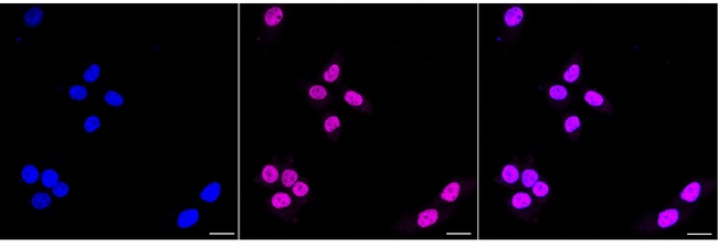PMS2 Antibody in Immunocytochemistry (ICC/IF)