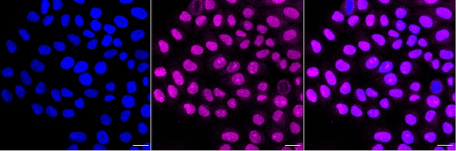 p16INK4a Antibody in Immunocytochemistry (ICC/IF)