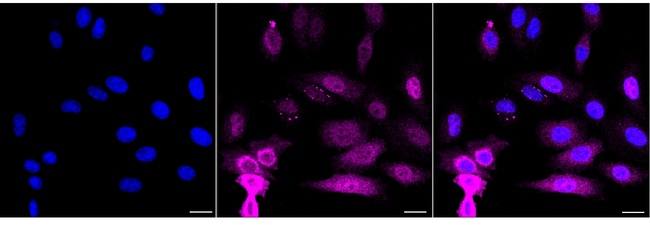 NFkB p52/p100 Antibody in Immunocytochemistry (ICC/IF)