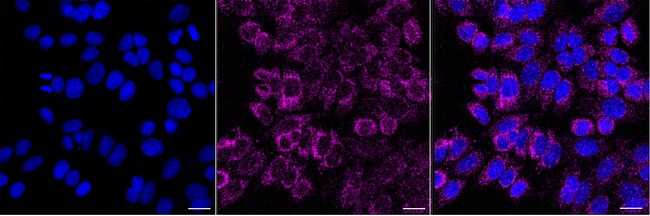 NDUFS1 Antibody in Immunocytochemistry (ICC/IF)