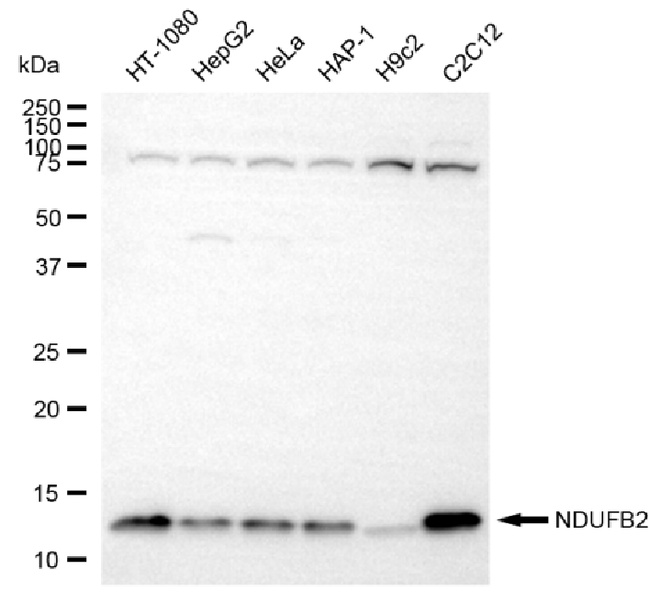 NDUFB2 Antibody in Western Blot (WB)