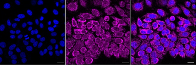 NDUFB11 Antibody in Immunocytochemistry (ICC/IF)