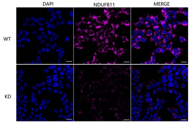 NDUFB11 Antibody in Immunocytochemistry (ICC/IF)