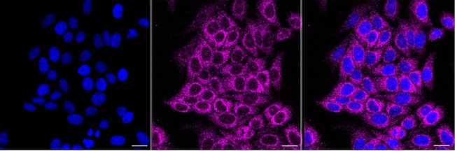 NDUFB10 Antibody in Immunocytochemistry (ICC/IF)