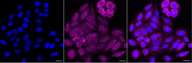 NDUFB1 Antibody in Immunocytochemistry (ICC/IF)