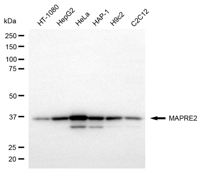MAPRE2 Antibody in Western Blot (WB)