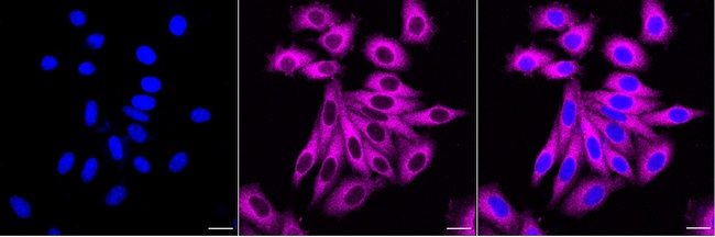 MAPRE2 Antibody in Immunocytochemistry (ICC/IF)