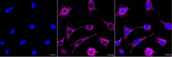 MAOA Antibody in Immunocytochemistry (ICC/IF)