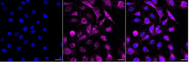 Laminin beta-1 Antibody in Immunocytochemistry (ICC/IF)