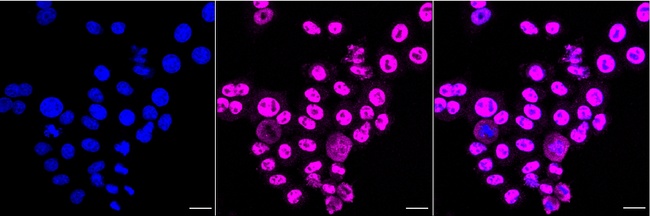 KLF4 Antibody in Immunocytochemistry (ICC/IF)