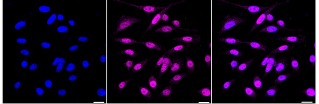 JunD Antibody in Immunocytochemistry (ICC/IF)