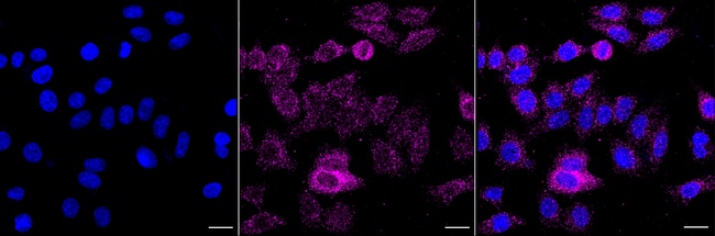 IKK beta Antibody in Immunocytochemistry (ICC/IF)