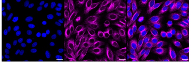 VEGF Receptor 1 Antibody in Immunocytochemistry (ICC/IF)