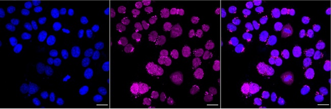HP1 alpha Antibody in Immunocytochemistry (ICC/IF)