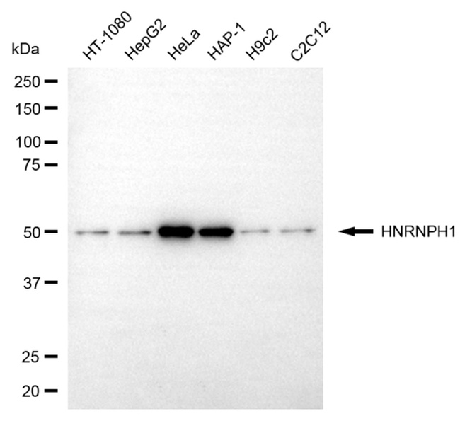 hnRNP H1 Antibody in Western Blot (WB)