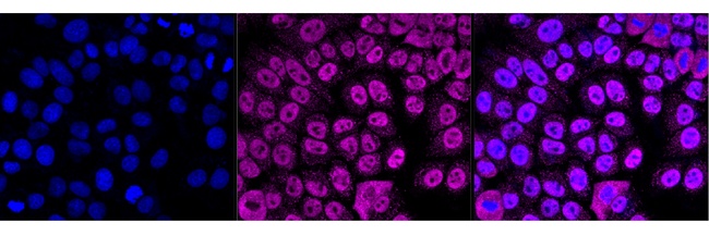 hnRNP F Antibody in Immunocytochemistry (ICC/IF)